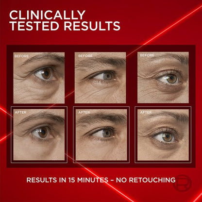 Sale Happening Now:70%OFF🔥 Eye Bag Instant Eraser, Tightens, Firms, & Blurs Wrinkles