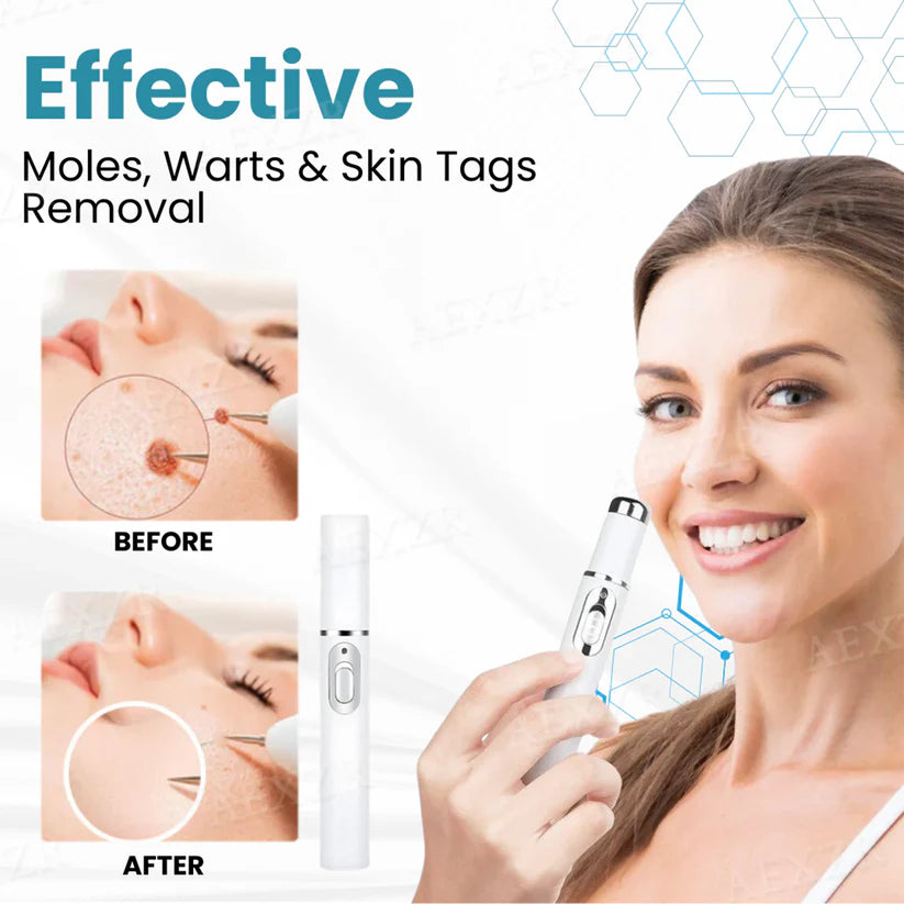 Bikenda® Non-Invasive Mole and Wart Removal Laser Pen Pro✨Last Day 50% OFF＆FREE SHIPPING🎁