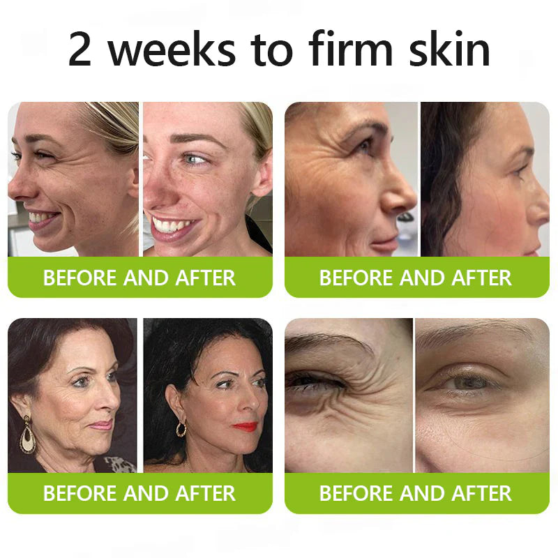 uk 𝑶𝒇𝒇𝒊𝒄𝒊𝒂𝒍 𝑺𝒕𝒐𝒓𝒆👩‍⚕️🎁| Regain youthful skin nown 💫STDEI® BOTOX & VITA A RETINOL SHOT Wrinkle Lift Tightening Cream