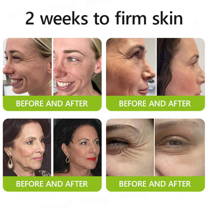 uk 𝑶𝒇𝒇𝒊𝒄𝒊𝒂𝒍 𝑺𝒕𝒐𝒓𝒆👩‍⚕️🎁| Regain youthful skin nown 💫STDEI® BOTOX & VITA A RETINOL SHOT Wrinkle Lift Tightening Cream