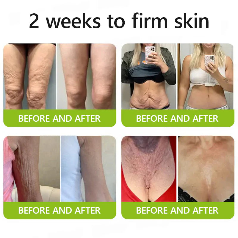 uk 𝑶𝒇𝒇𝒊𝒄𝒊𝒂𝒍 𝑺𝒕𝒐𝒓𝒆👩‍⚕️🎁| Regain youthful skin nown 💫STDEI® BOTOX & VITA A RETINOL SHOT Wrinkle Lift Tightening Cream