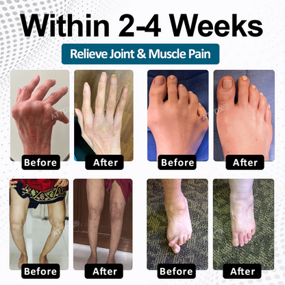 🔥BLACK FRIDAY warm-up: 70%OFF🔥 BPC-157 ArthroFlex Motion+ Capsules