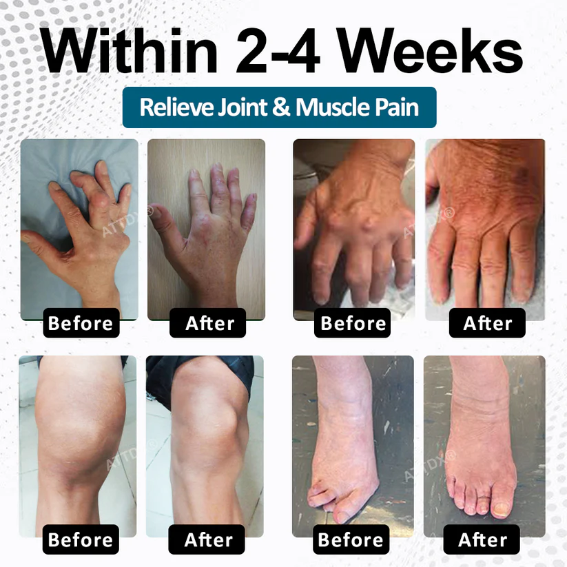 🔥BLACK FRIDAY warm-up: 70%OFF🔥 BPC-157 ArthroFlex Motion+ Capsules