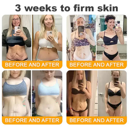 70% OFF🔥𝐋𝐎𝐕𝐈𝐋𝐃𝐒™ 𝐁𝐞𝐞 𝐕𝐞𝐧𝐨𝐦 𝐀𝐥𝐥-𝐢𝐧-𝐎𝐧𝐞 𝐂𝐫𝐞𝐚𝐦–🌸 Anti-aging,Hydrating, Skin Repair, Even Tone, Acne and Dark Spot Treatment, Wart and Mole Removal, Psoriasis Relief