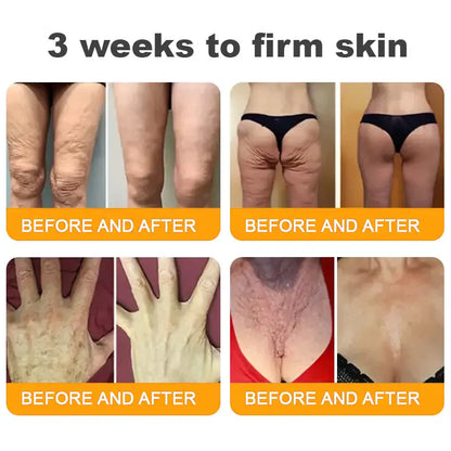 70% OFF🔥𝐋𝐎𝐕𝐈𝐋𝐃𝐒™ 𝐁𝐞𝐞 𝐕𝐞𝐧𝐨𝐦 𝐀𝐥𝐥-𝐢𝐧-𝐎𝐧𝐞 𝐂𝐫𝐞𝐚𝐦–🌸 Anti-aging,Hydrating, Skin Repair, Even Tone, Acne and Dark Spot Treatment, Wart and Mole Removal, Psoriasis Relief