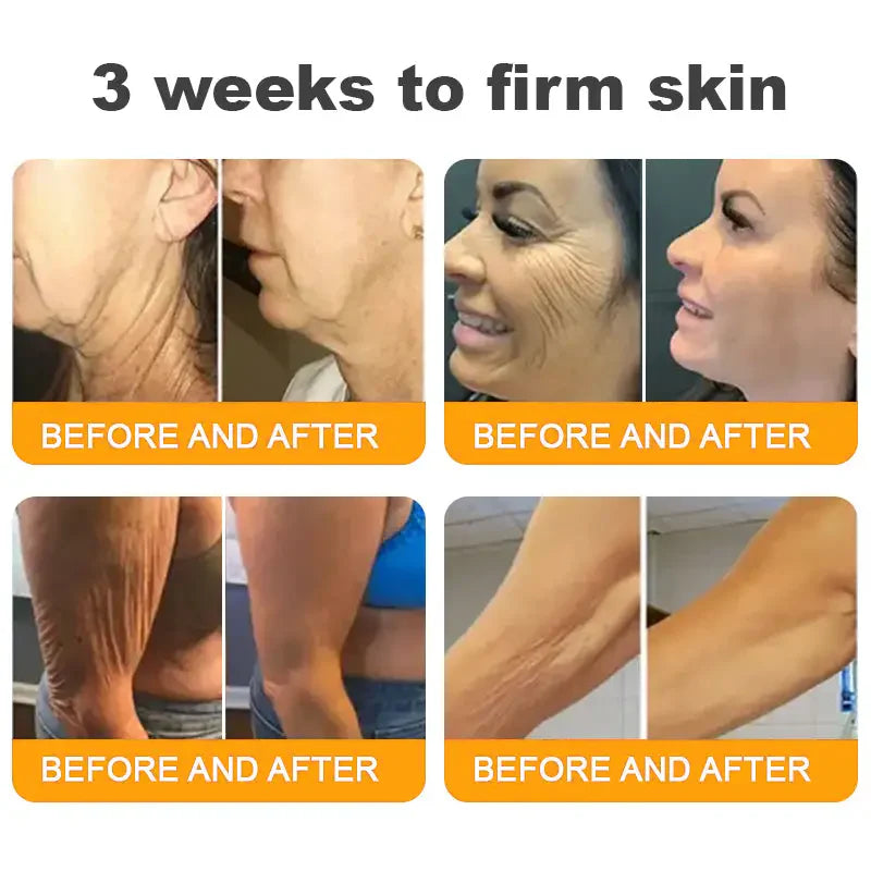 70% OFF🔥𝐋𝐎𝐕𝐈𝐋𝐃𝐒™ 𝐁𝐞𝐞 𝐕𝐞𝐧𝐨𝐦 𝐀𝐥𝐥-𝐢𝐧-𝐎𝐧𝐞 𝐂𝐫𝐞𝐚𝐦–🌸 Anti-aging,Hydrating, Skin Repair, Even Tone, Acne and Dark Spot Treatment, Wart and Mole Removal, Psoriasis Relief