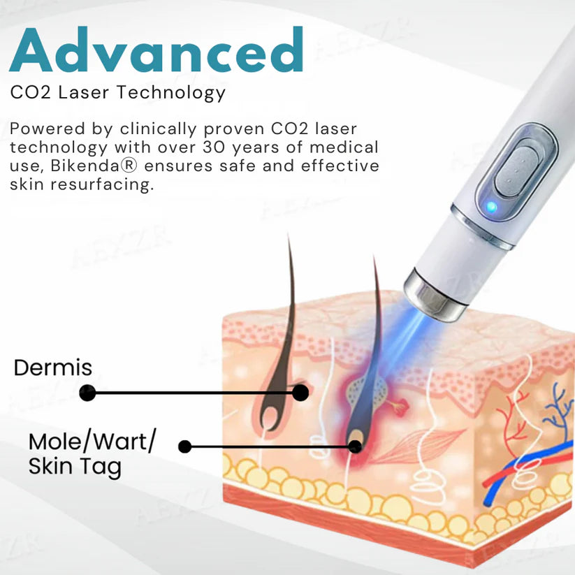 Bikenda® Non-Invasive Mole and Wart Removal Laser Pen Pro✨Last Day 50% OFF＆FREE SHIPPING🎁